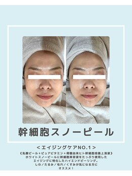 ソワナ(soina)/【神楽坂駅/フェイシャル/毛穴】