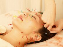 美容鍼は線維芽細胞を活性化しコラーゲン,エラスチンを生成