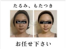 女性のための女性による小顔美容矯正専門店です。