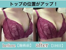 サラエクセレント 銀座/デコルテふんわりバストアップ！