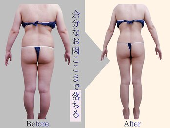 プレリー 自由が丘店/セルゼロ/筋膜リリース