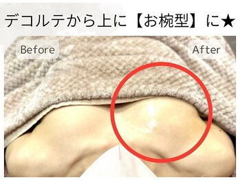 ボニービューティー(Bony Beauty)/BeforeAfter【2】