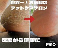 ピーアンドオー(P&O)