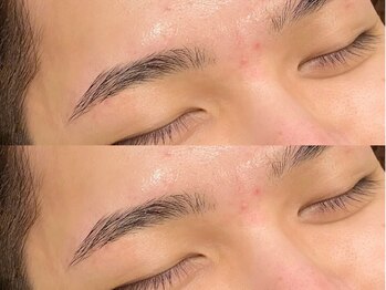 アイクイック 北千住店(Ai Quick)/メンズアイブロウワックス脱毛