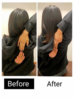 アース エンジェル整体院/ビフォアフ 肩甲骨はがし