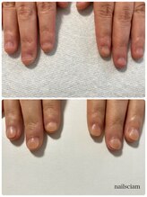 ネイルズシアム/深爪矯正　