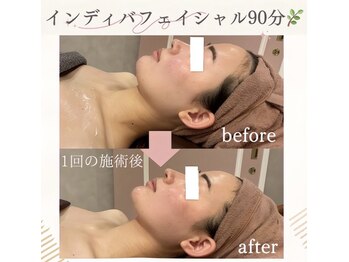 ナルシス(Narcissus)/インディバフェイシャル90分