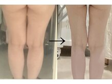 シュシュエステプリューム(Chou Chou Esthe PLUME)/