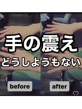 カワル整体 上通り院/どうしようもない手の震え