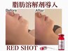 【初回・脂肪分解剤2cc導入】RED SHOT★もたつきスッキリフェイスライン♪
