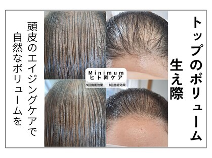 ミニマム(minimum)の写真