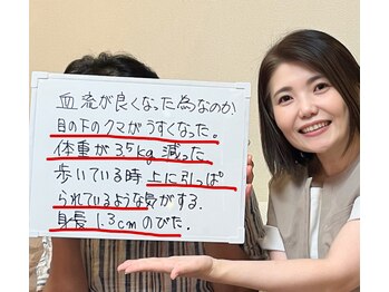 オステオデイジー(OsteoDaisy)/目の下のクマ、身長と体重の変化