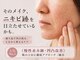 アロマ(AROMA)の写真