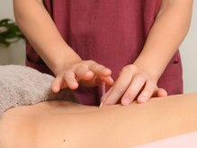 森ノ宮アクア鍼灸治療院/施術風景