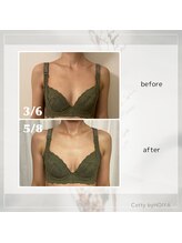 コティーバイホイヤ(Cotty by HOIYA)/バストアップコースのお客様