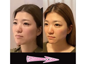 ネルジム 札幌店(NERU GYM)/一回目で大きな効果の小顔矯正