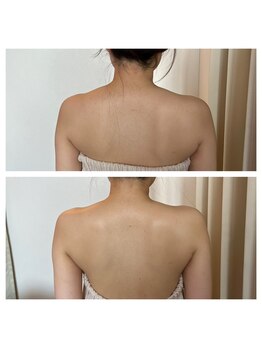 ビューティースタジオ韓美 いわき平/ブライダルエステ☆駆け込みOK!