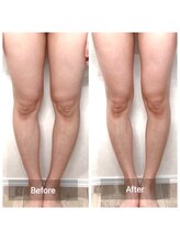 神谷澤鍼灸整骨院/before after