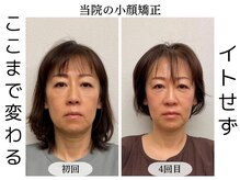 横浜駅きた西整体院/頭蓋骨小顔矯正整体5