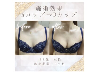 ハリスタ(HARISTA)の写真