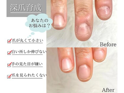 レア(le'a)の写真