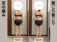 モモナ(Momona)/#肩こり#リンパマッサージ#野並