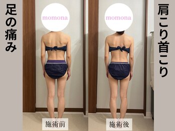 モモナ(Momona)/#肩こり#リンパマッサージ#野並