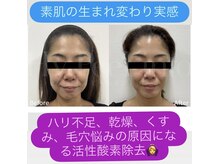 根本改善！敏感肌の方も◎お悩み別肌質改善＊最新肌管理