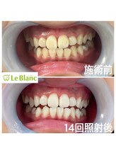 ルブラン 奈良店(Le Blanc)/ショートフリーパス！