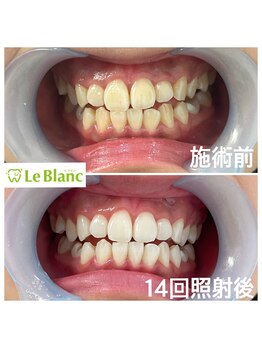 ルブラン 奈良店(Le Blanc)/ショートフリーパス！