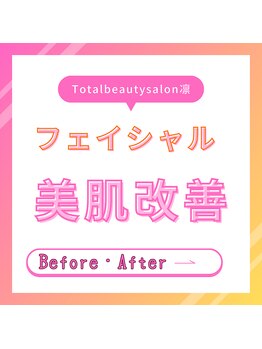 トータルビューティーサロン 凛/肌改善のビフォーアフター