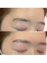 フレイズラピス(FRASE Lapis)/【ハリウッドブロウリフト】