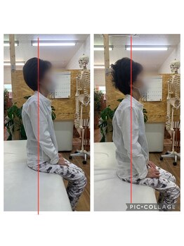 カインド整体院(KiND整体院)/背中がホントに楽です!