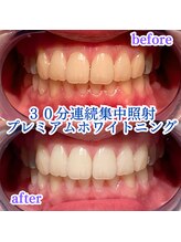 プラスビーセルフ(+b self)/30分連続照射＊ホワイトニング