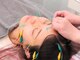 しんのう鍼灸院の写真/【JMCAA認定技術"立体造顔美容鍼(R)"】皮膚科学×生理学に基づいた技術で理想のフェイスラインを叶えます♪
