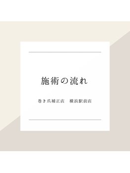 巻き爪補正店 横浜駅前店/～施術の流れ～