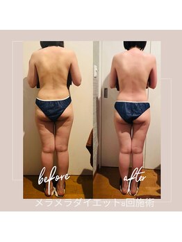 バンブー B2 新涯店(Bamboo)/メラメラダイエットコース