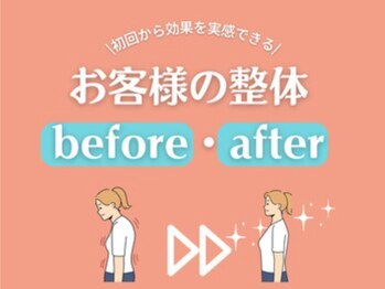 ディボード(Debord)/お客様の整体　before after