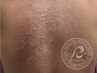 【Body】剥離ありリベルハーブピーリング ¥22000/新規☆次回使える¥3000券