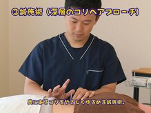 たくあん鍼灸院/3鍼施術（深層へのアプローチ）