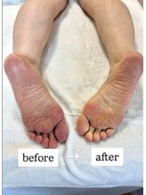 グリッター ショウナン(glitter. SHONAN)/足裏、冷え浮腫解消★藤沢整体