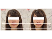 イリス 神田(iris)/即実感！小顔集中ケア