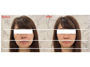 イリス 神田(iris)/即実感!小顔集中ケア