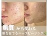 【本気で肌を変えたい方へ】 初回来店｜肌質改善カウンセリング & 施術★