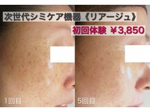 ブランシェ 富山店 × 椿