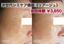 ブランシェ 富山店 × 椿