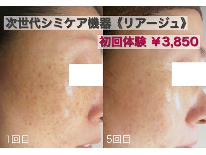 ブランシェ 富山店 × 椿の写真