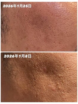 ダリア(Dahlia)/インセルダム