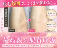 ミーシェ(Meshie)