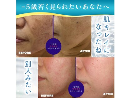 フェイシャル専門サロン サロン ド ウイッシュの写真